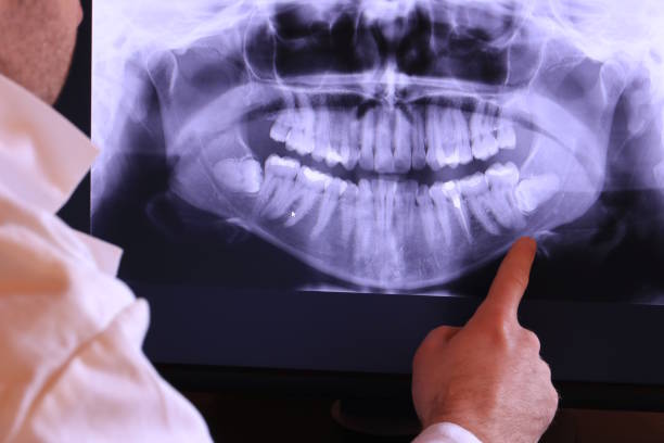 Best Walk-In Emergency Dentist in Walnut Grove, CA